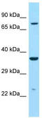 Iduronidase Alpha-L- antibody, TA343325, Origene, Western Blot image 