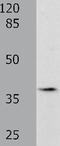 Brain Derived Neurotrophic Factor antibody, TA323908, Origene, Western Blot image 