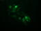 Ubiquitin-conjugating enzyme E2 S antibody, M03045, Boster Biological Technology, Immunofluorescence image 