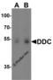 Dopa Decarboxylase antibody, 7447, ProSci, Western Blot image 