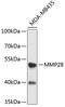 Matrix metalloproteinase-28 antibody, 19-508, ProSci, Western Blot image 