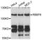 RB Binding Protein 8, Endonuclease antibody, abx126459, Abbexa, Western Blot image 