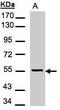 Aspartyl Aminopeptidase antibody, GTX101993, GeneTex, Western Blot image 