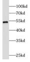 Serine/Threonine Kinase 11 antibody, FNab04802, FineTest, Western Blot image 