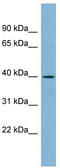 ETS Variant 3 Like antibody, TA342393, Origene, Western Blot image 