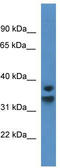 NFKB Inhibitor Delta antibody, TA343012, Origene, Western Blot image 