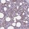 Neutrophil cytosol factor 1 antibody, NBP2-33502, Novus Biologicals, Immunohistochemistry frozen image 