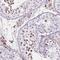 Kinetochore protein Spc24 antibody, PA5-62352, Invitrogen Antibodies, Immunohistochemistry paraffin image 