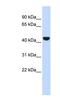 Keratin 19 antibody, NBP1-53204, Novus Biologicals, Western Blot image 