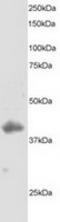Dual specificity protein phosphatase 1 antibody, TA302731, Origene, Western Blot image 