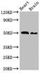 Vacuolar Protein Sorting 4 Homolog B antibody, LS-C680004, Lifespan Biosciences, Western Blot image 