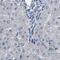 Plakophilin-2 antibody, PA5-53144, Invitrogen Antibodies, Immunohistochemistry frozen image 