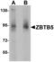 Zinc Finger And BTB Domain Containing 5 antibody, LS-C144305, Lifespan Biosciences, Western Blot image 