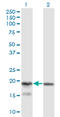 Killer Cell Lectin Like Receptor C4 antibody, LS-C198544, Lifespan Biosciences, Western Blot image 