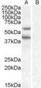Diacylglycerol O-acyltransferase 2 antibody, NB100-57851, Novus Biologicals, Western Blot image 