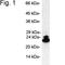 Proteasome Subunit Beta 9 antibody, NB300-625, Novus Biologicals, Western Blot image 