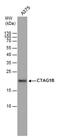 Cancer/Testis Antigen 1B antibody, PA5-77931, Invitrogen Antibodies, Western Blot image 