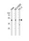 Nuclear Receptor Subfamily 0 Group B Member 1 antibody, abx031637, Abbexa, Western Blot image 