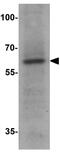 Malic Enzyme 1 antibody, GTX31914, GeneTex, Western Blot image 