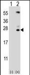 Kallikrein Related Peptidase 6 antibody, PA5-35312, Invitrogen Antibodies, Western Blot image 