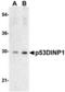 Tumor Protein P53 Inducible Nuclear Protein 1 antibody, TA306110, Origene, Western Blot image 