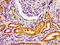 G Protein-Coupled Receptor Kinase 3 antibody, CSB-PA001395LA01HU, Cusabio, Immunohistochemistry paraffin image 