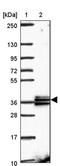 Retinol Dehydrogenase 14 antibody, PA5-63341, Invitrogen Antibodies, Western Blot image 