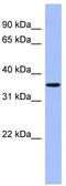Protein Phosphatase, Mg2+/Mn2+ Dependent 1A antibody, TA344616, Origene, Western Blot image 