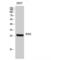 Brain-specific homeobox protein homolog antibody, LS-C382323, Lifespan Biosciences, Western Blot image 