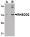 Rhomboid domain-containing protein 2 antibody, PA5-20861, Invitrogen Antibodies, Western Blot image 