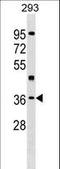 HLF Transcription Factor, PAR BZIP Family Member antibody, LS-C159846, Lifespan Biosciences, Western Blot image 