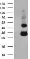 Uridine-Cytidine Kinase 1 antibody, CF501543, Origene, Western Blot image 