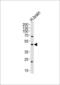 Monoacylglycerol lipase ABHD12 antibody, GTX80950, GeneTex, Western Blot image 