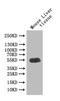 GDNF Family Receptor Alpha Like antibody, CSB-PA751020LA01HU, Cusabio, Western Blot image 