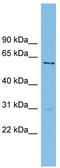 Cysteine And Serine Rich Nuclear Protein 1 antibody, TA344648, Origene, Western Blot image 