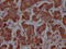 Solute Carrier Family 16 Member 1 antibody, CSB-RA919798A0HU, Cusabio, Immunohistochemistry paraffin image 