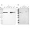 Acyl-CoA Dehydrogenase Very Long Chain antibody, NBP1-89287, Novus Biologicals, Western Blot image 