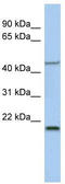 Kruppel Like Factor 15 antibody, TA329447, Origene, Western Blot image 