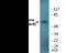 Tyrosine Hydroxylase antibody, EKC2132, Boster Biological Technology, Western Blot image 