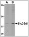 Solute Carrier Family 35 Member D1 antibody, AP23853PU-N, Origene, Western Blot image 