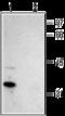 Calcium Voltage-Gated Channel Auxiliary Subunit Gamma 2 antibody, GTX16605, GeneTex, Western Blot image 