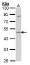 GDI1 antibody, GTX101731, GeneTex, Western Blot image 