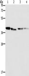 Branched Chain Amino Acid Transaminase 2 antibody, TA349705, Origene, Western Blot image 