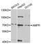 Autocrine motility factor receptor, isoform 1 antibody, STJ22602, St John