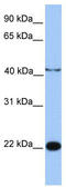 Chromosome 2 Open Reading Frame 68 antibody, TA334941, Origene, Western Blot image 