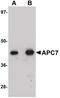 Anaphase Promoting Complex Subunit 7 antibody, PA5-20948, Invitrogen Antibodies, Western Blot image 