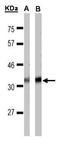 Free fatty acid receptor 1 antibody, GTX100290, GeneTex, Western Blot image 