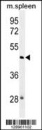 NOP2/Sun RNA Methyltransferase 3 antibody, 55-760, ProSci, Western Blot image 