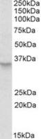 Peroxisome biogenesis factor 2 antibody, MBS422386, MyBioSource, Western Blot image 