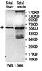 NFKB Inhibitor Zeta antibody, orb78193, Biorbyt, Western Blot image 